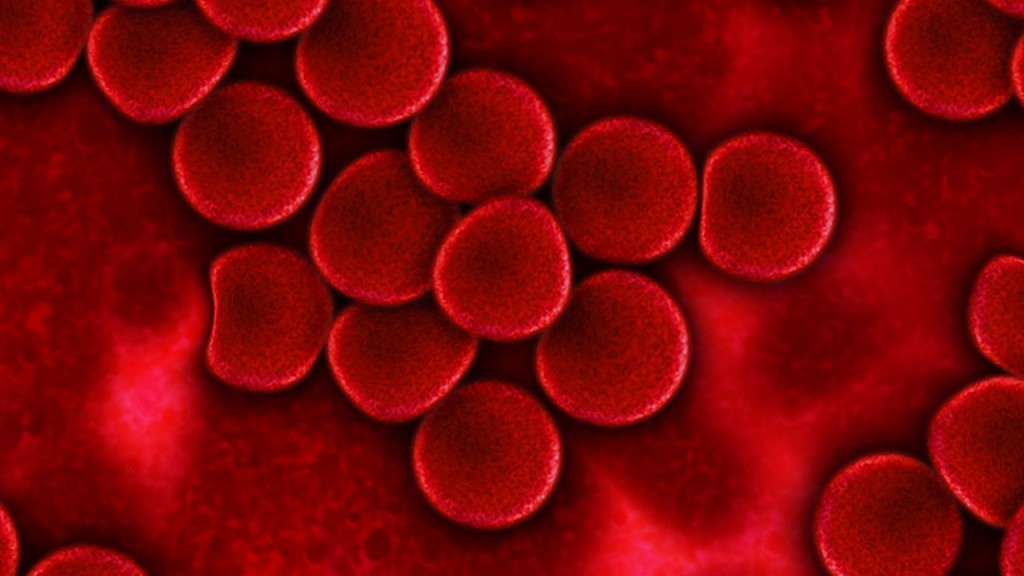 Что такое анемия и какие виды анемии существуют?