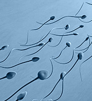 Правильная спермограмма — что покажет анализ?