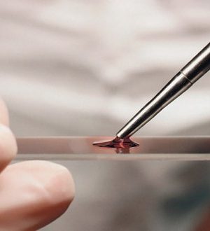 Нормальный общий анализ крови — что это значит?