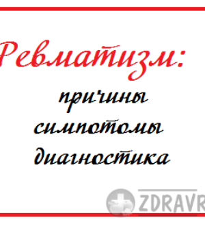 Ревматизм — причины, диагностика, симптомы