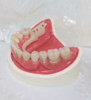 Съемные зубные протезы, современные виды и особенности