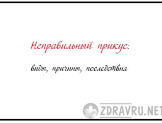 Неправильный прикус: виды, причины, лечение