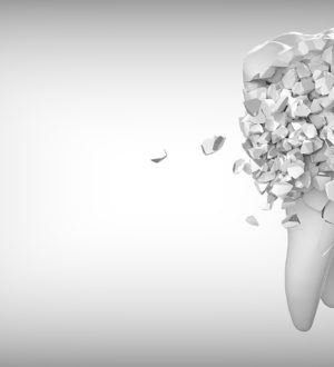 Пломба или вкладка?