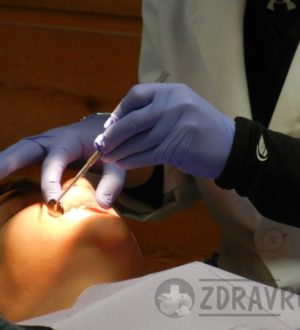 Зубной флюс… или Что такое одонтогенный периостит?