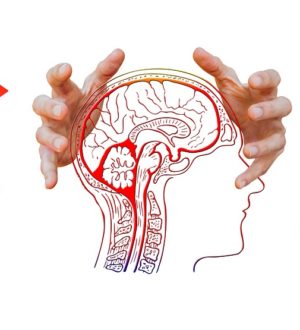 Виды инсульта