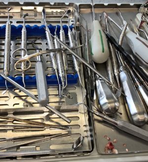 Современные методы стоматологии — какие инновации пришли на смену устаревшим методам лечения зубов?