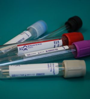 Лимфоцитарный профиль крови