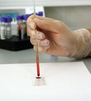 Клинический анализ крови