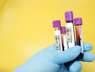 Гематокрит (HCT)