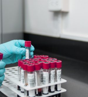 Нейтрофилы в крови (NEUT)