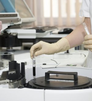 Лимфоциты в крови (LYMPH)