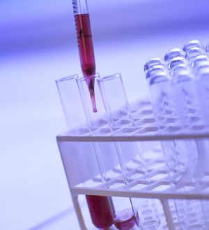 Моноциты в крови (MONO)