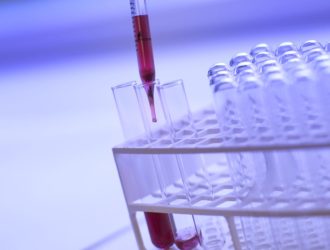 Моноциты в крови (MONO)