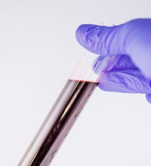 Базофилы в крови (BASO)