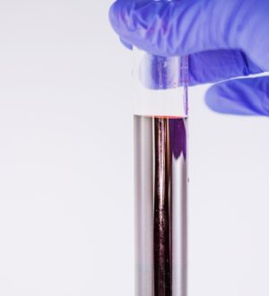 Активированное частичное тромбопластиновое время (АЧТВ) — норма, результат и расшифровка