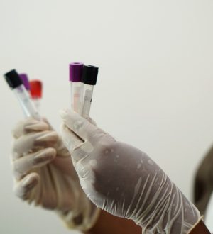 Д-димер — что это за анализ, норма, результат и расшифровка