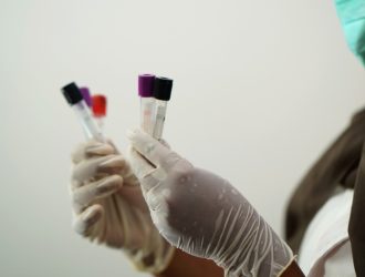 Д-димер — что это за анализ, норма, результат и расшифровка