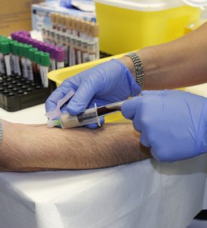 Тромбиновое время — что это значит, норма, показатели, расшифровка