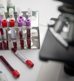 Гормон андростендион — за что отвечает, как сдают, норма, расшифровка анализа