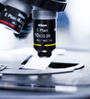 Лютеинизирующий гормон — за что отвечает, как сдавать, норма по возрасту, расшифровка анализа