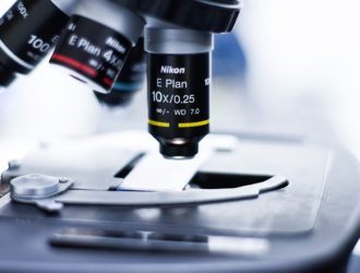 Лютеинизирующий гормон — за что отвечает, как сдавать, норма по возрасту, расшифровка анализа