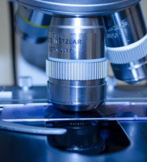 Пероксидаза щитовидной железы — что означает, норма, расшифровка анализа